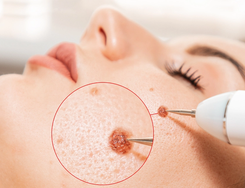 Top-rated cosmetic procedure clinics in Ottawa Top-rated cosmetic procedure clinics in Ottawa