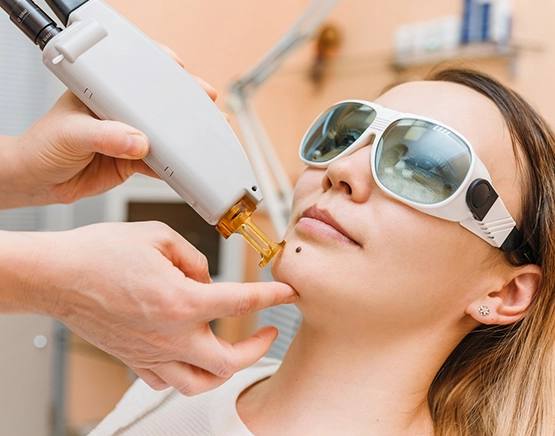 mole removal ottawa Affordable cosmetic mole removal procedures in Ottawa